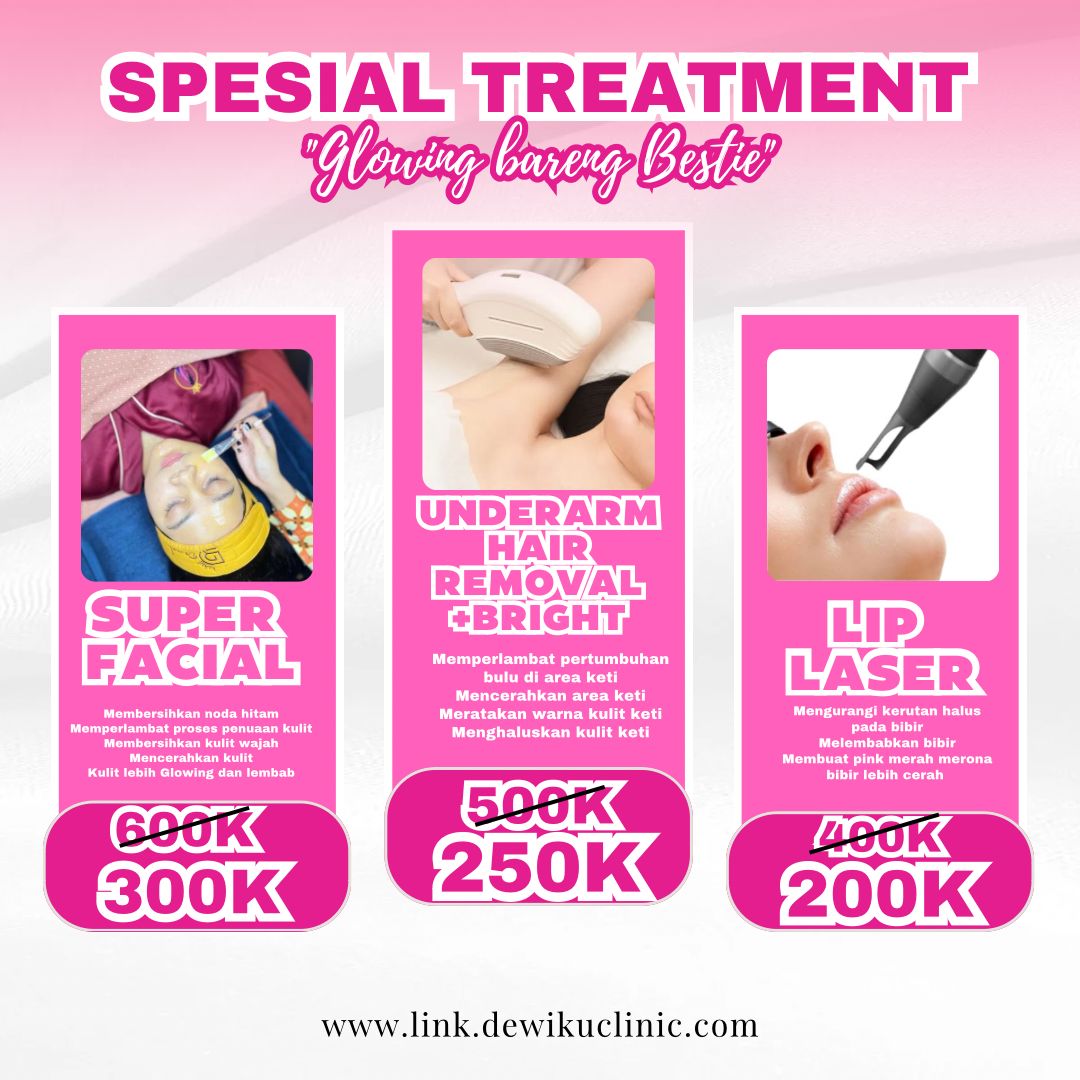 SPECIAL TREATMENT DEWIKU