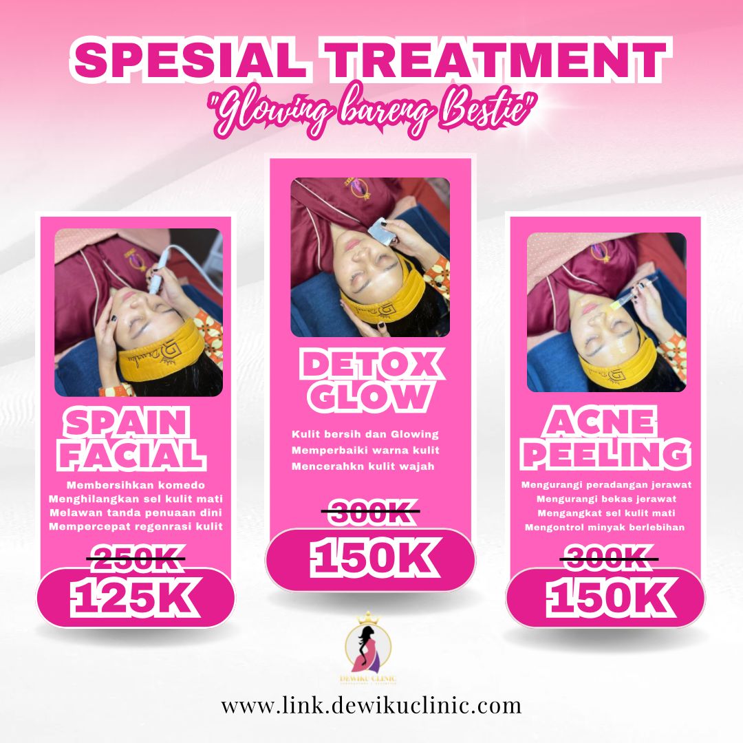 SPECIAL TREATMENT